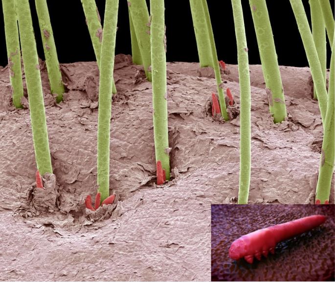 まつ毛ダニ 画像